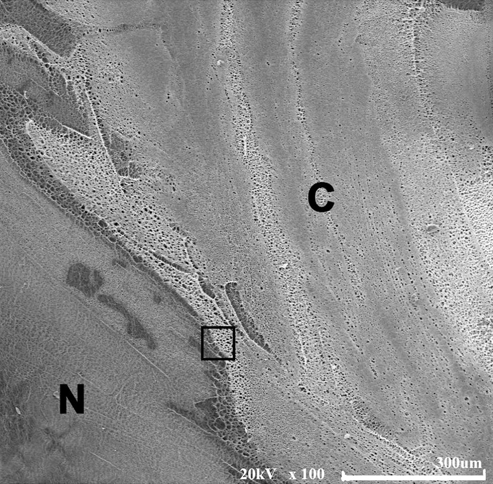 - 대한안과학회지 2014년 제 55 권 제 5 호 - A B C D Figure 5. Scanning electron microscopic photographs of cosmetic contact lens surface and its Pseudomonas aeruginosa adhesions.