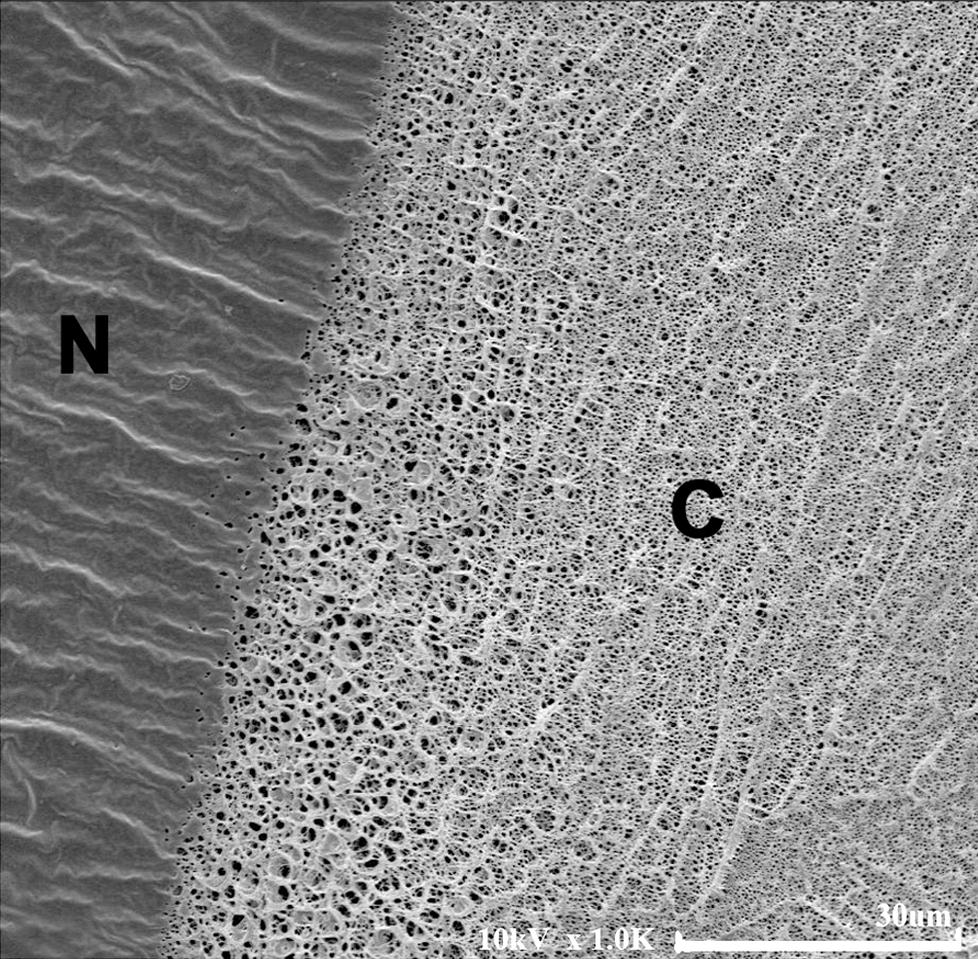 Especially, more bacterial adhesions were found to color tinted area ( 2000). (D) P. aeruginosa adhesion to surface of CL was observed at high magnification ( 10000).