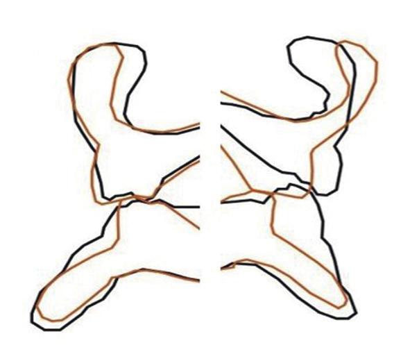 premolar area () and molar