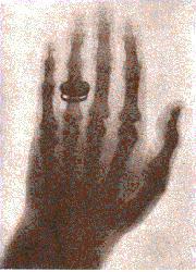 z In November 1895 z Report of his discovery of short-wave radiations that he called X-rays