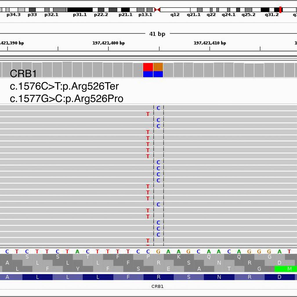 arg526pro variants were presented in different reads, visualized by Integrative genomics viewer. These 2 variants were present in trans, so segregation analysis is not needed. bp = base pair.