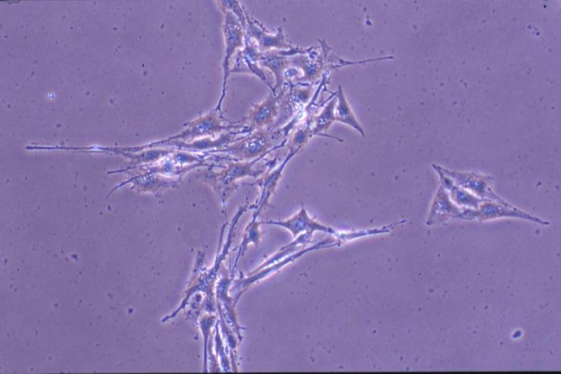 2) 식물추출물이 B16 melanoma 세포형태에미치 는영향을알아보기위해 12가지식물추출물을 B16 melanoma 세포에처리한후 inverted microscope 을통해세포모양을관찰하였다. 가장 큰모양변화를보인것은모과추출물을처리한 세포로아무것도처리하지않은군에비해세포 크기가커지고배양접시바닦에납작하게퍼져 있는것을관찰할수있었다.