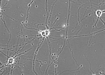 without grating> Cultured neurons on polymer with