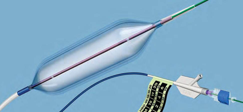 Hercules 3 stage wire guided dilation balloon catheter: 3 단계와이어가이드장착확장풍선카테터 강하고정확하게확장시킵니다 식도, 유문, 십이지장및대장의협착을효과적으로관리하기위해정확하고단계적으로확장가능한강력한풍선카테터가필요합니다. Cook Hercules 는이모두를충족시킬수있습니다. 특화된 P.E.T.