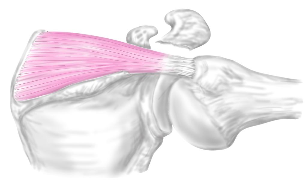 제 02 장 회전근개손상 극상근 supraspinatus 견봉 acromion 견갑근 shoulder 근의수축중력에의해팔을내리는힘 그림 2-8 상지거상시극상근봉합부에더해진역학적부하 상지거상에수반해, 봉합부보다중추부에서는근수축에의해기시부로, 말초부에서는중력에의해부착부로각각힘이더해진다. 봉합부에는박리스트레스가발생한다.