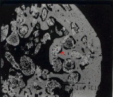 (Fluorecent microscope, x100), Fig. 5. Fluorecent marking( ) around new osteon on coral HA.