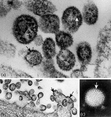 실험실획득감염 - Sabia virus NEJM 1995