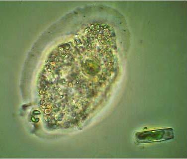 Although we can't see them, protozoa do a lot for us. Protozoa play a useful role in the food chain as a source of food for fish and other animals.