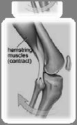 hamstring strength Hamstrings protect ACL