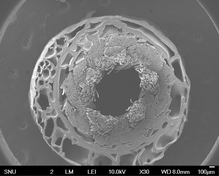 Cross-section images of patterned hollow fiber