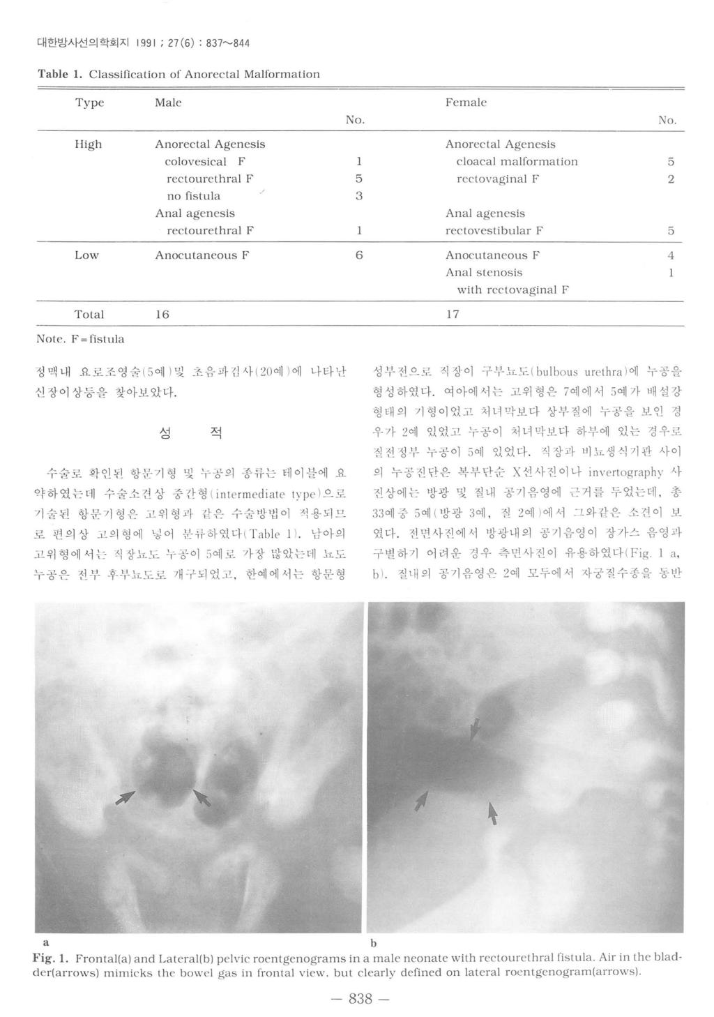 대한방사선의학회지 1991 ; 7(6) : 837~844 Table l.