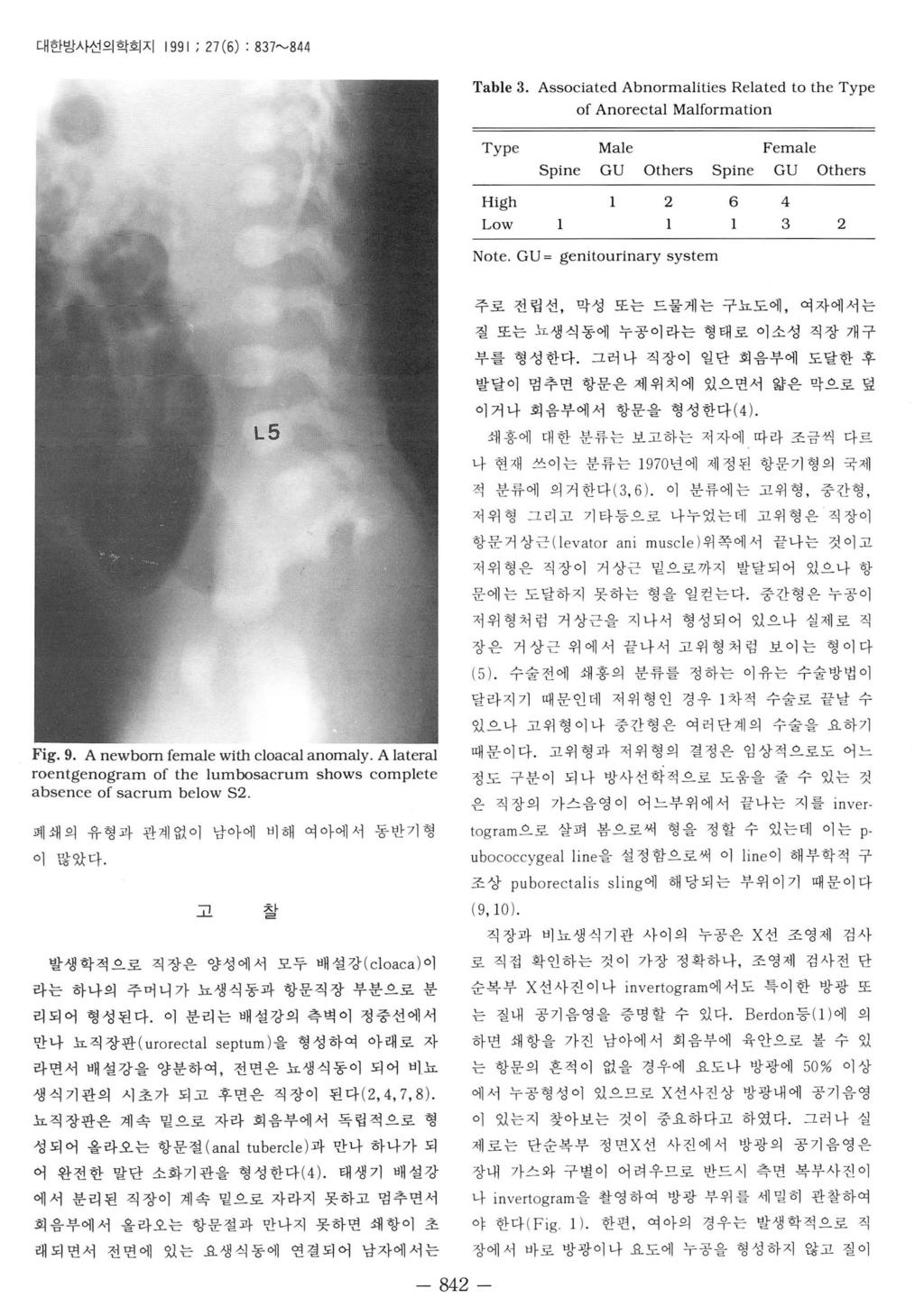대한방사선의학회지 1991 ; 7 (6) : 837"-'844 Table 3. Associated Abnormalities Related to the Type of Anorectal Malformation Type Male Female Spine GU Others Spine GU Others High 6 4 Low 3 Note.