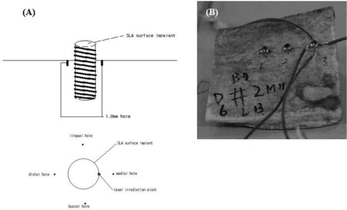 Jin WF, et al: Bacteria removal in a SD rat peri-implantitis model using diode laser of 808 nm and 810 nm 3 Fig. 2. In vitro 열발생측정. (A) 소뼈에 SLA-TS 식립모식도와레이저조사위치에대한 schematic graph.