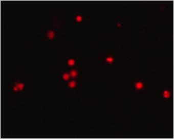 파란색으로표시된부분이 Hoechst 33342로염색된생세포의핵으로서용매대조군은핵고유의둥근형태를유지하는반면천년초시료를처치한군은농도가증가할수록핵이손상되었으며세포질분리, chromtin 응축등이나타나는 poptotic ody가관찰되었다.