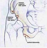 Common Features of occult Groin Injuries 4.