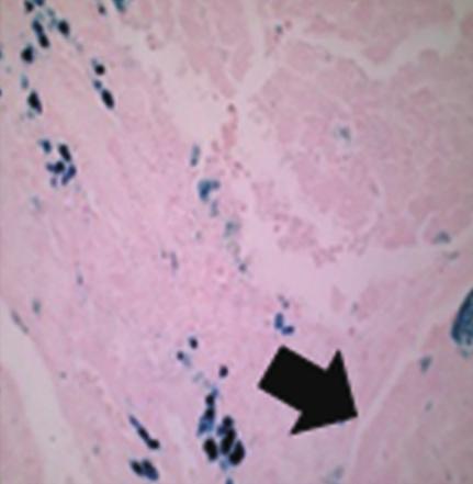 Sample groups were Mock liver compared and analyzed with Student's t-test using GraphPad software. P <0.