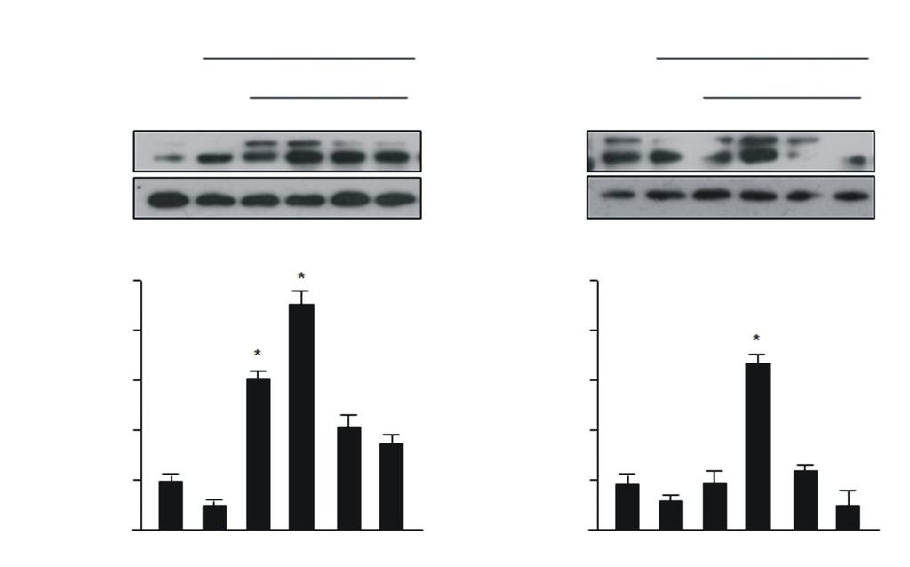 - 우종은외 : 스트레스환경에서 TonEBP 의발현 - A TonEBP GAPDH + STD B + STD NaCl ( mm) Mannitol ( mm) -STD V 6 hours -STD V 6 hours TonEBP GAPDH C D TonEBP/GAPDH Protein (Fold change) TonEBP/GAPDH Protein (Fold