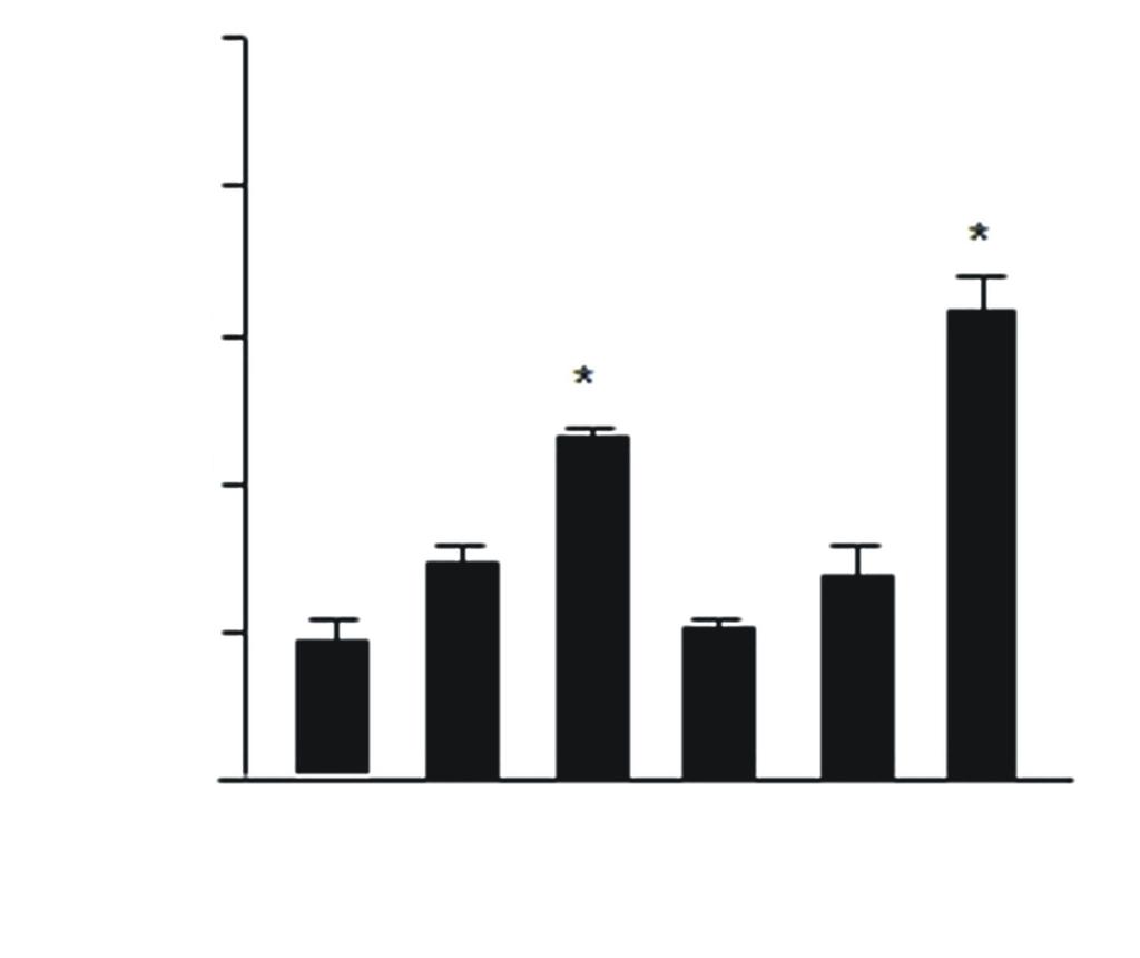 다음으로 mm glucose를, 6,, 시간처리한실험에서는통계적으로 시간, 시간경과후의발현정도가유의성있게나타났으며 glucose 처리후 시간째증가했다가이후 6시간째감소후시간이지나면서다시증가하는양상을보였다 (Fig. ). B β-actin TonEBP/GAPDH Protein (Fold change) Figure.