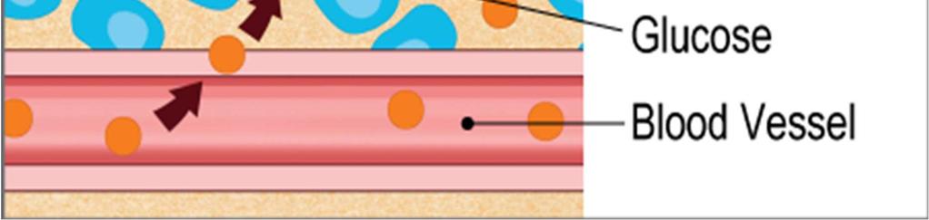 Dexcom, 미래에셋대우리서치센터 그림 28.