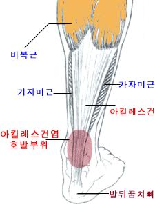 와건 (tendon) 의유연성감소 02 인대
