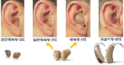 8 노화로인한청각의변화 노인성난청의원인 1 주로와우모세포와청신경세포의퇴행성변화 2 중이, 내이, 청신경, 청중추등청각계전반에걸친기능저하