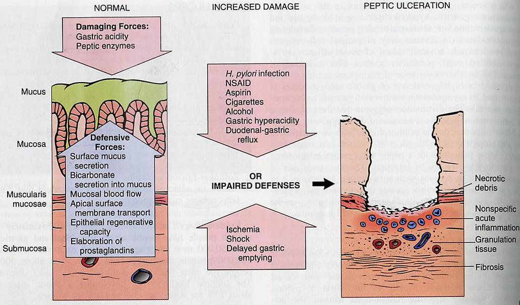 Pathogenesis of