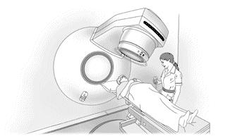 RADIOTHERAPY Radiotherapy is not usually used to treat cancer of the stomach. This is because the stomach is so close to other major organs that it is difficult to give effective treatment.