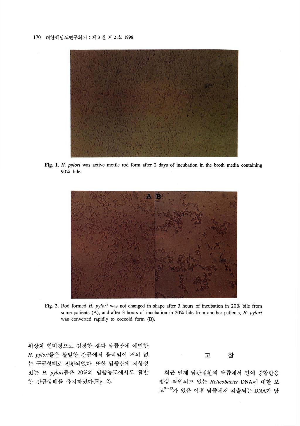 170 대한쉐담도연구회지, 제 3 권제 2 호 1998 Fig. 1. H. pylori was active moti1e rod fonn after 2 days of incubation in the broth media containing 90% bi1e. Fig. 2. Rod fonned H.