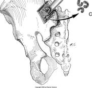 (Posterolateral