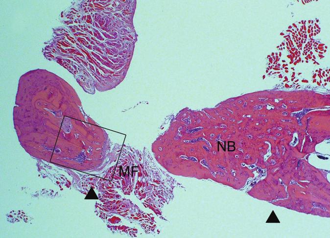 Representative photomicrographs of mandibular defects receiving the bovine collagen matrix at 8 weeks (B; boxed area in A).