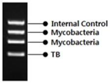 NTM TB IC : Internal Control NC : Negative control, PC : Positive control