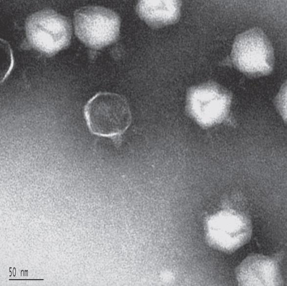 E. coli phage T7 Phage T7 은 icosahedral head 이며짧은 tail 을갖고있다.