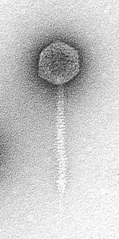 8.4 Temperate Phage Temperate phage 의대표적인것으로 phage λ 가있으며 lytic 혹은 lysogenic cycle 을갖음 Phage λ 는 icosahedral head 이고길고수축되지않는유연성있는 tail 이있다.