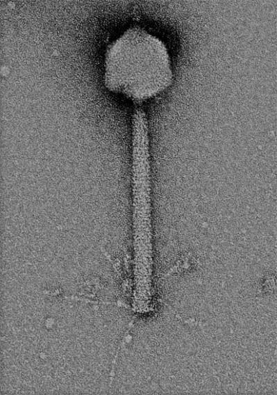 Phage P1 Contractile sheath 로둘러싸인 tail tube 로이루어진 tail 과한쪽은 icosahedral head 와연결되고다른끝은 6 개의꼬인 tail fiber 가있는 base plate 임.