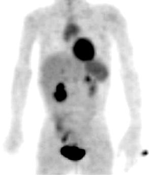 head) and right axillar area (black arrow).