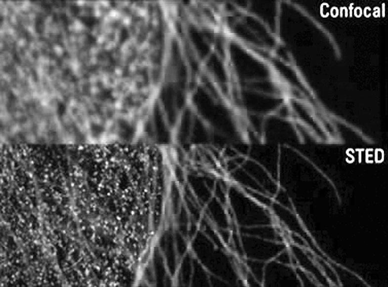 ISSUE 1 초고감도분자및세포측정용분광이미징장비 그림 1-4 STED 현미경으로얻은세포내히스톤단백질과 microtuble 이미지 * 출처 :