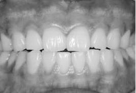 12) 치과에서레이저기기가구강연조직에치료에쓰이는경우는다양하다.