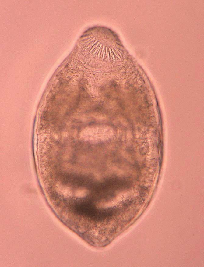 Sohn et al.: Centrocestus armatus metacercaria in fish from Korea 343 OS VS EB A B Fig. 1.