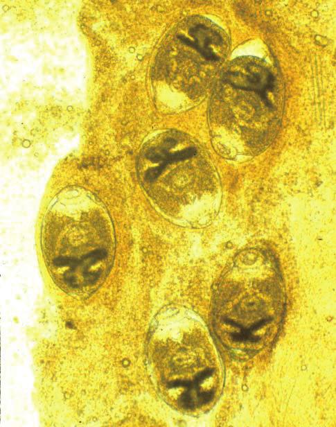 12 mm in size, providing 42 circumoral spines around oral sucker (OS) arranged 2 rows, a ventral sucker (VS) in the median and X-shaped excretory bladder (EB). Scale bar is 0.1 mm. in 12 spp.