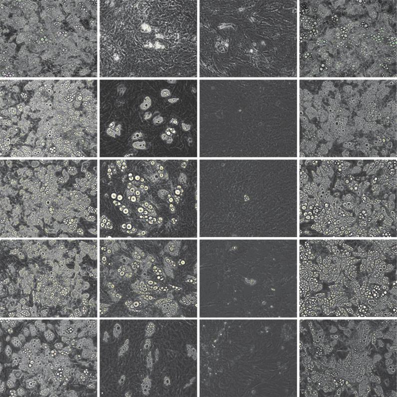 (magnification, 200). Fig. 4. Comparisons in the differentiation were examined by Oil red O stain for adipogenesis.