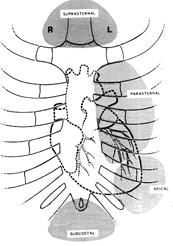 순환기질환의총론 2. Echocardiography 1) 개요초음파를이용하여심근벽, 심장의내부구조, 주변조직의위치나운동을기록하는방법으로임상에서다양한목적으로널리이용되고있는검사방법이다.