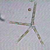Diatoms (