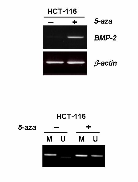 Figure 8. RT PCR analysis after treatment with 5-aza-2 - Deoxycytidine (5-aza).