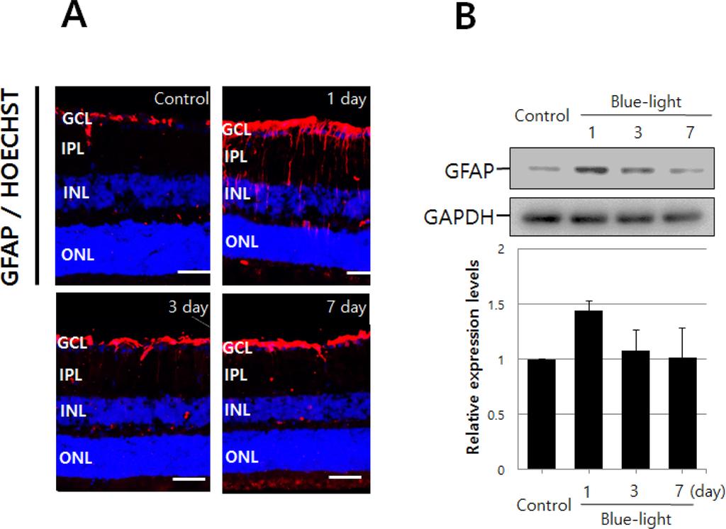 Blue-light Induces the Selective Cell Death of Photoreceptors in Mouse Retina 71 anti-phosphorylated c-jun(1:1000, Cellsignaling Technology, 연구에서는 마우스를 24시간 동안 암순응 시키고 6시간 USA), rabbit polyclonal