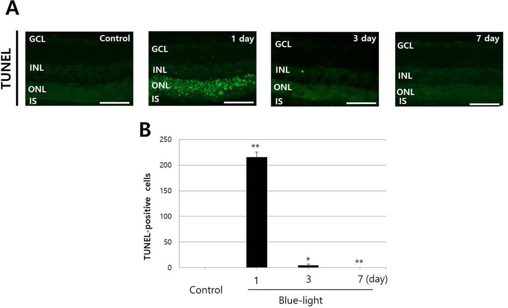 Blue-light Induces the Selective Cell Death of Photoreceptors in Mouse Retina 73 Fig. 4. Blue-light promotes the cell death of photoreceptors.