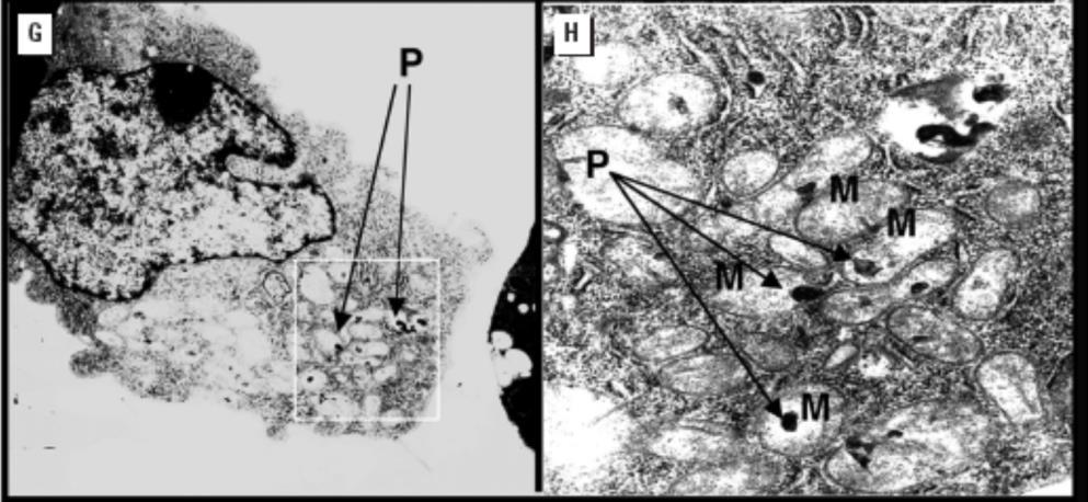 found in damaged mitochondria Coarse