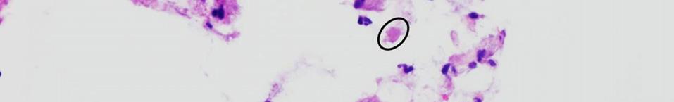 Giardia lamblia 의영양형은크기가약 10-15 μm로배 (pear) 모양으로 2개의 찰 핵과 4쌍의섬모를갖고있으며, 포낭은크기가 8-12 μm로둥근모양에 2개또는 4개의핵이굴절성의외벽에둘러싸여있다 [7].