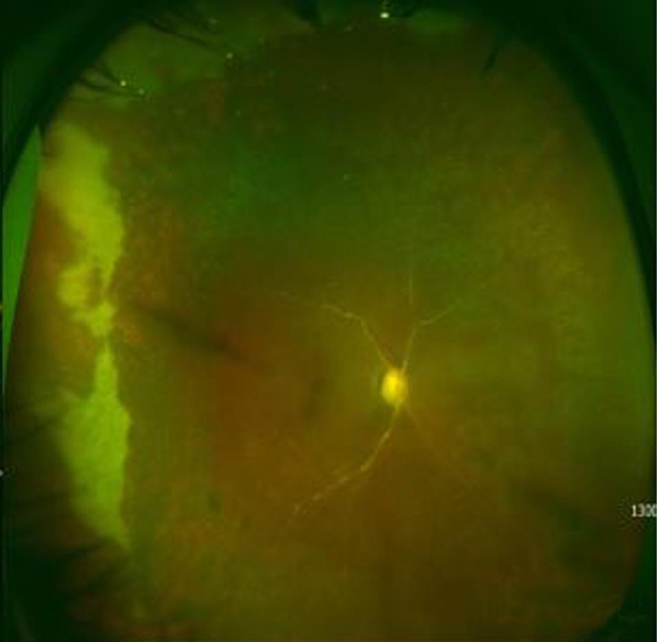 Chronologic order of ultra-wide fundus images during the patient