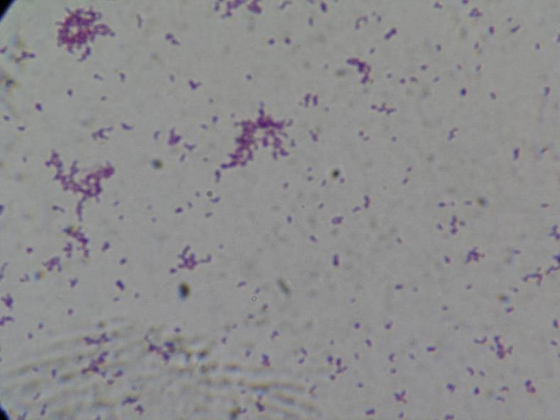 Fig. 2. Gram stain morphology of A.haemolyticum. 1000. Fig. 3.