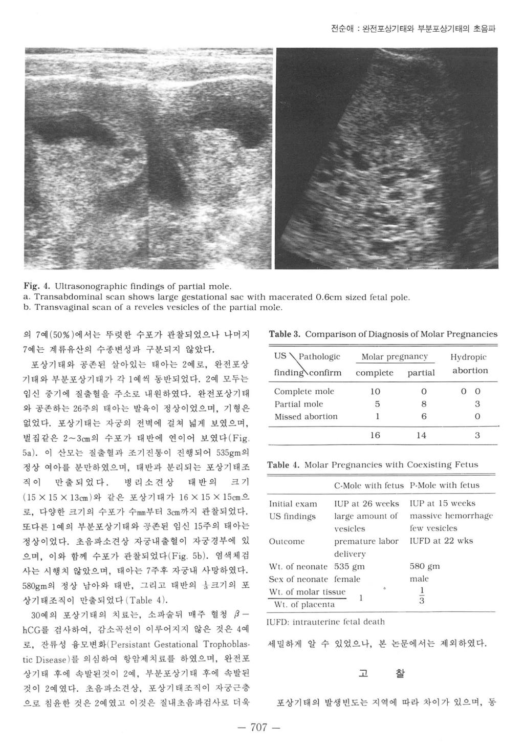 전순애 완전포상기태와부분포상기태의초음파 F ig. 4. Ultrsonogrphic findings of pr til m ole.. Trnsdominl scn shows lrge gesttion l sc with mcerted O.6cm sized fetl pole.